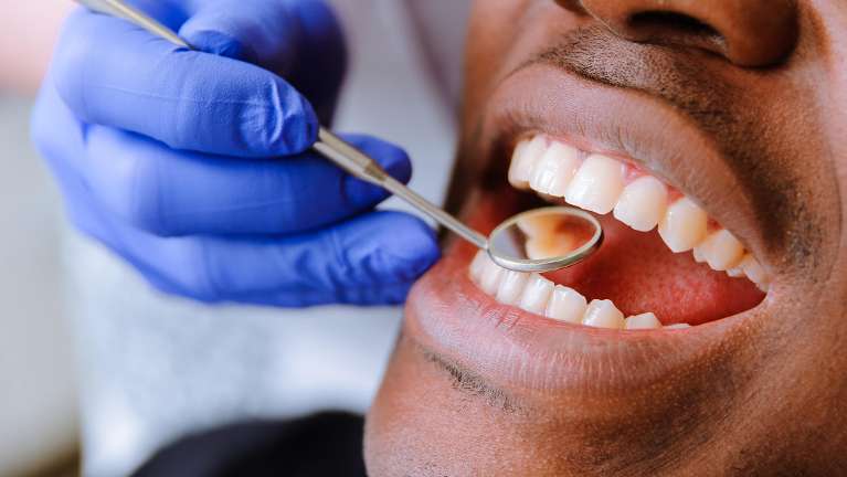 Man receiving a dental exam | Dentist Chesterfield, MO
